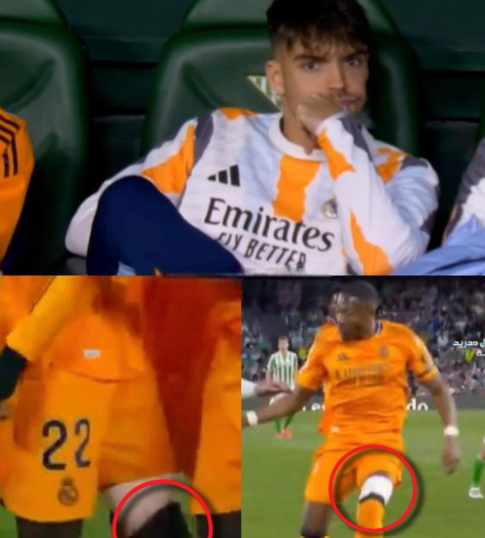 Asencio en el banquillo con Alaba y Rüdiger vendados abajo